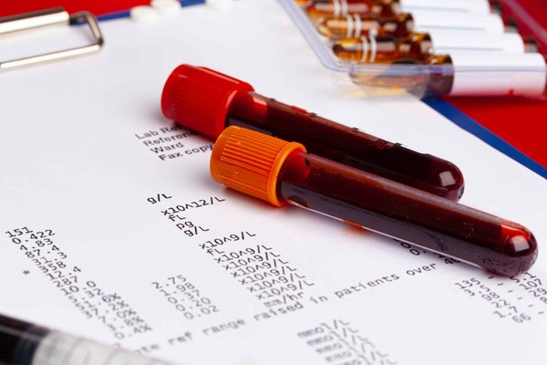 De la protection de la planète à la protection des habitants : l'essor des diagnostics environnementaux en région PACA